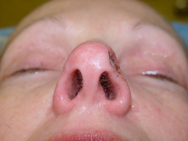 A close up of a woman 's nose with her eyes closed.