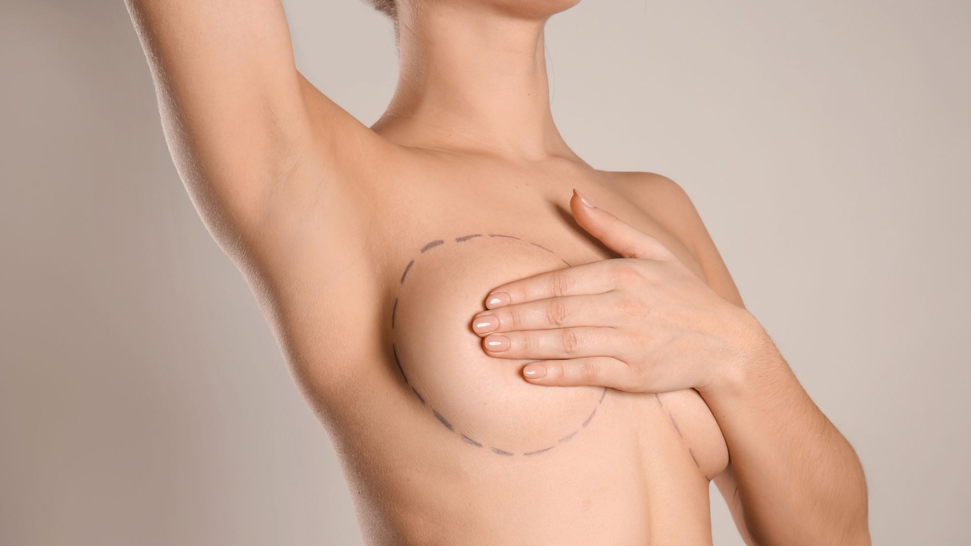 breast reconstruction surgery charleston