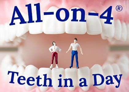 all-on-6-all-on-6-dental-implants-full-arch-teeth-same-day