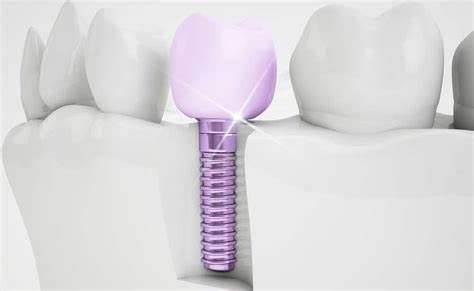 Emergency-Dentist-Lawrenceville-NJ-Same-Day-Dental-Care-609-400-1393
