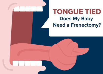 Tongue tied: does my baby need a frenectomy?