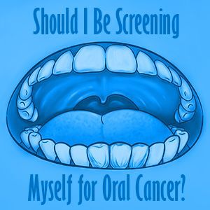 Lawrenceville dentist, Dr. Maxim Godko at Deluxe Dentistry talks about the prevalence of oral cancer and shares how to check your mouth at home.