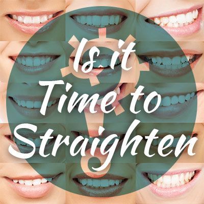 Lawrenceville dentist, Dr. Maxim Godko at Deluxe Dentistry, shares the different factors to consider when contemplating the best time to straighten your teeth.