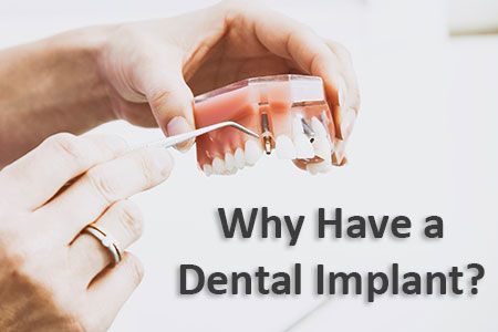 Why have a dental implant?