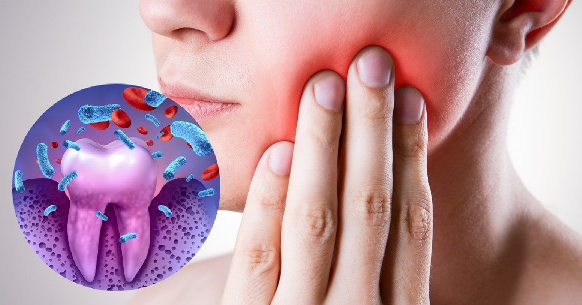 Dental-Emergency-Dentist-Dental Infection-Infections-Lawrenceville-NJ