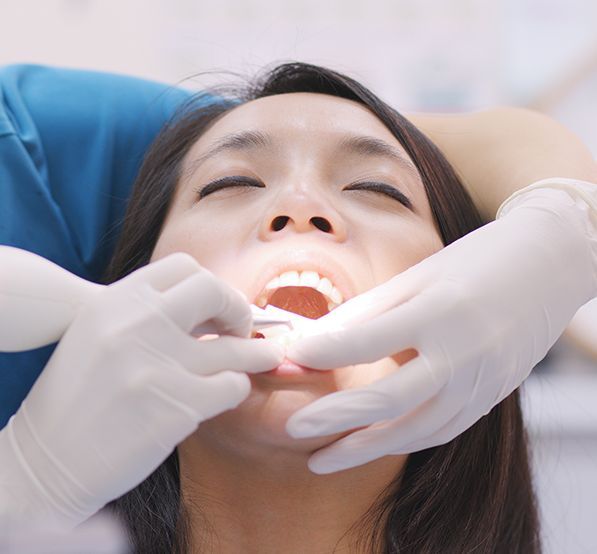 Deep Cleaning-Scaling and Root Planning Dental Care.