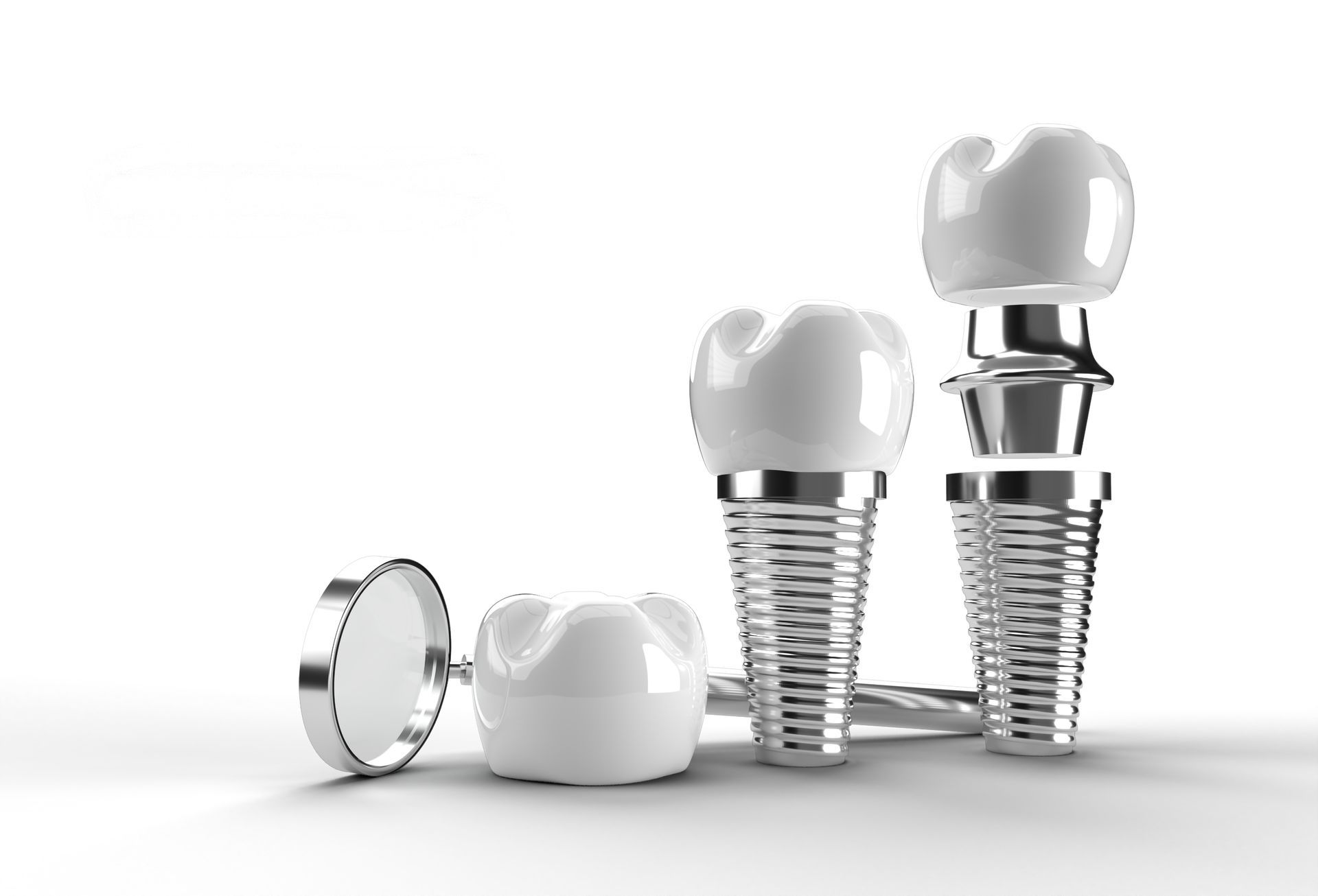 Dental Implants