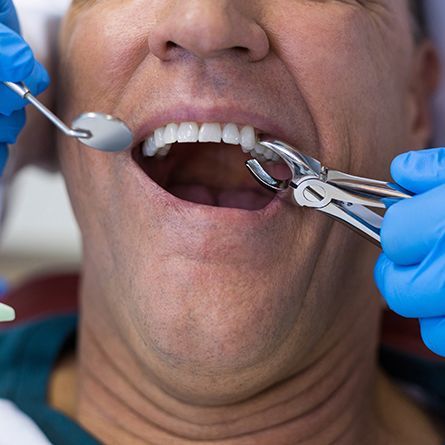 chekups-cleanings-root-scaling-xrays-cavities-fillings-diagnosis-preventive-dental-care-dentist-lawrenceville-nj