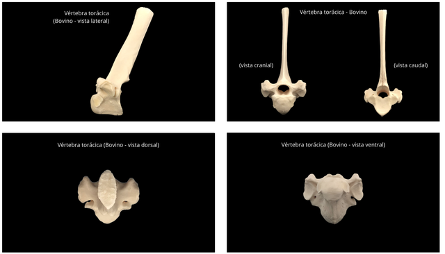 vértebras torácicas vista lateral