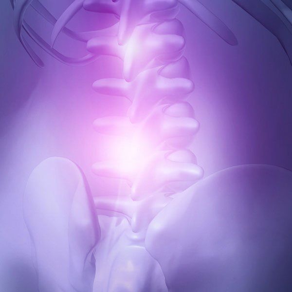 Back problems and human backache pain as an upper torso body skeleton showing the spine and vertebral column in highlight as a medical health care concept for spinal surgery and therapy on white