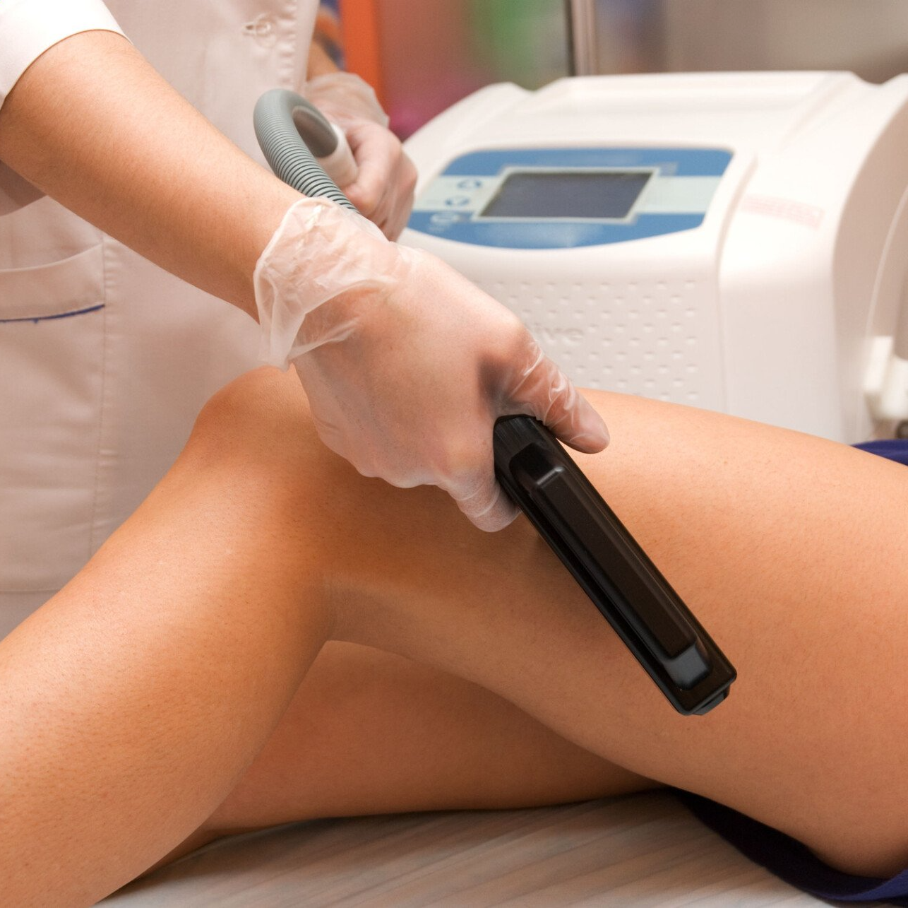 Laser treatment of leg