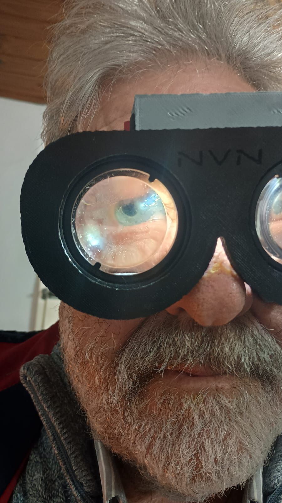 lentes de frenzel