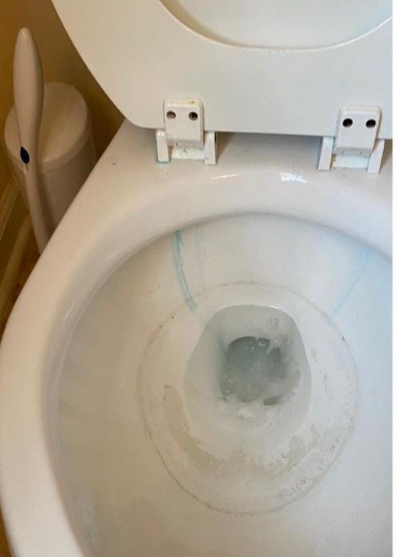 A close-up of a toilet bowl with a blue cleaning agent streak and white stains.