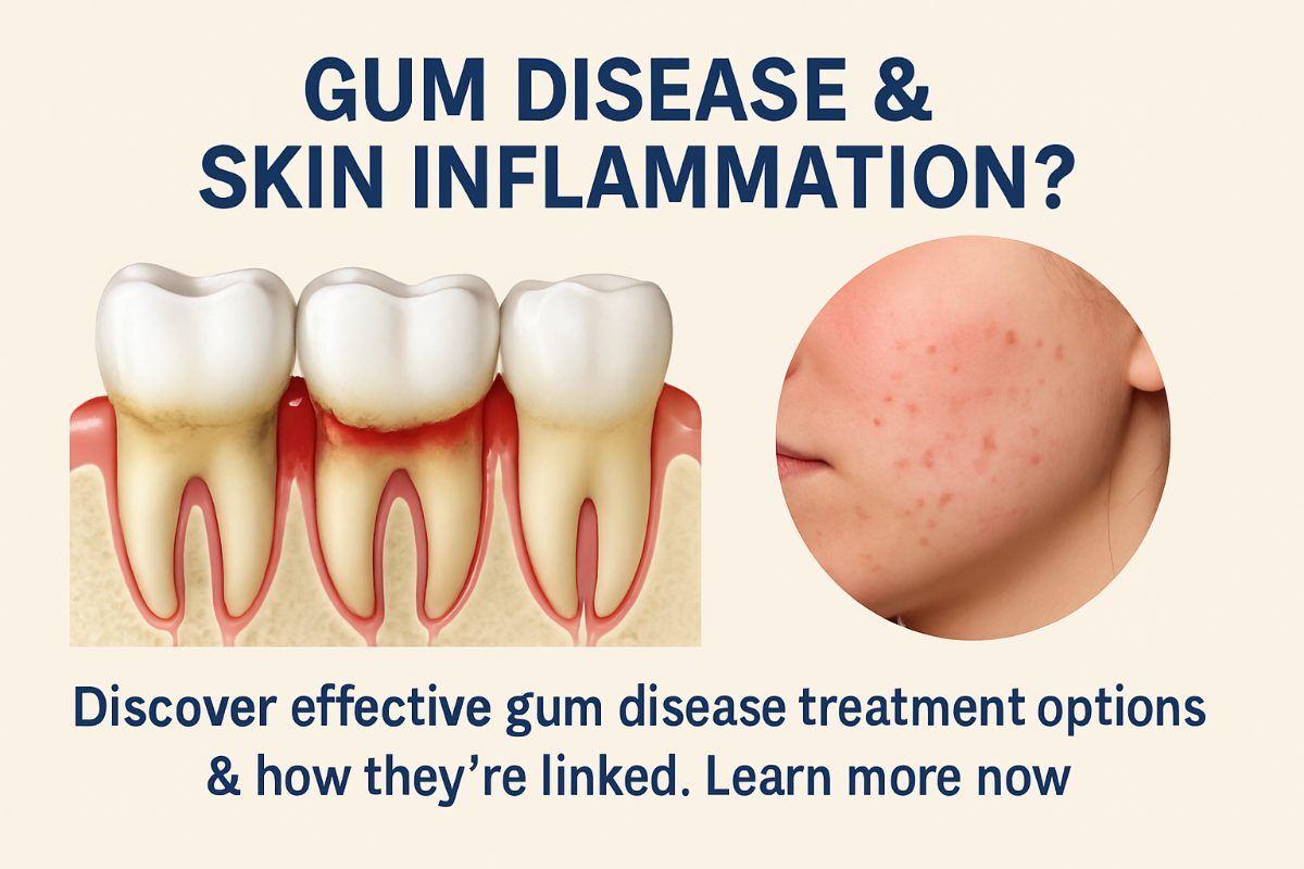 Image of a person with periodontitis has red, inflamed gums with visible dermatitis or rash on their face. No text on image.