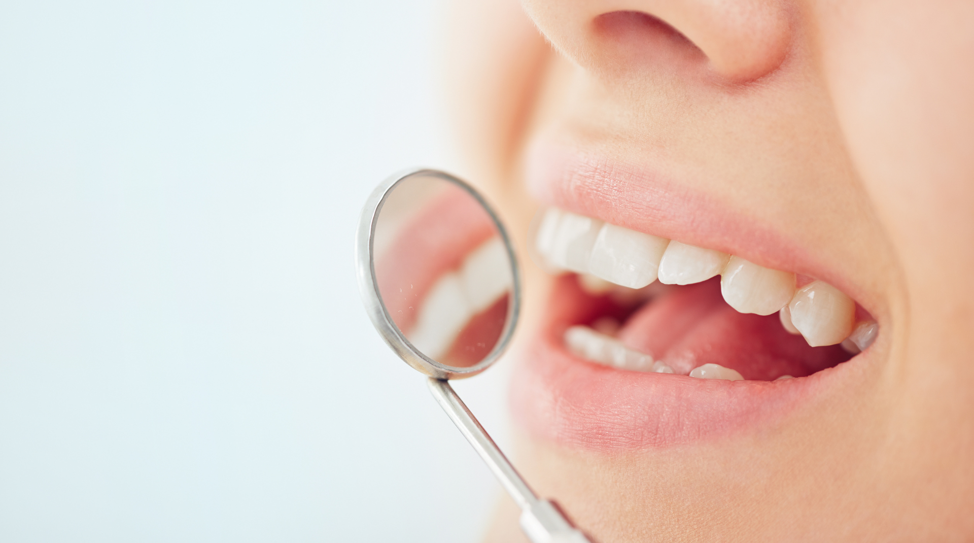 How Crooked Teeth Can Affect Gum Tissue Health : Tetra Health Dentistry