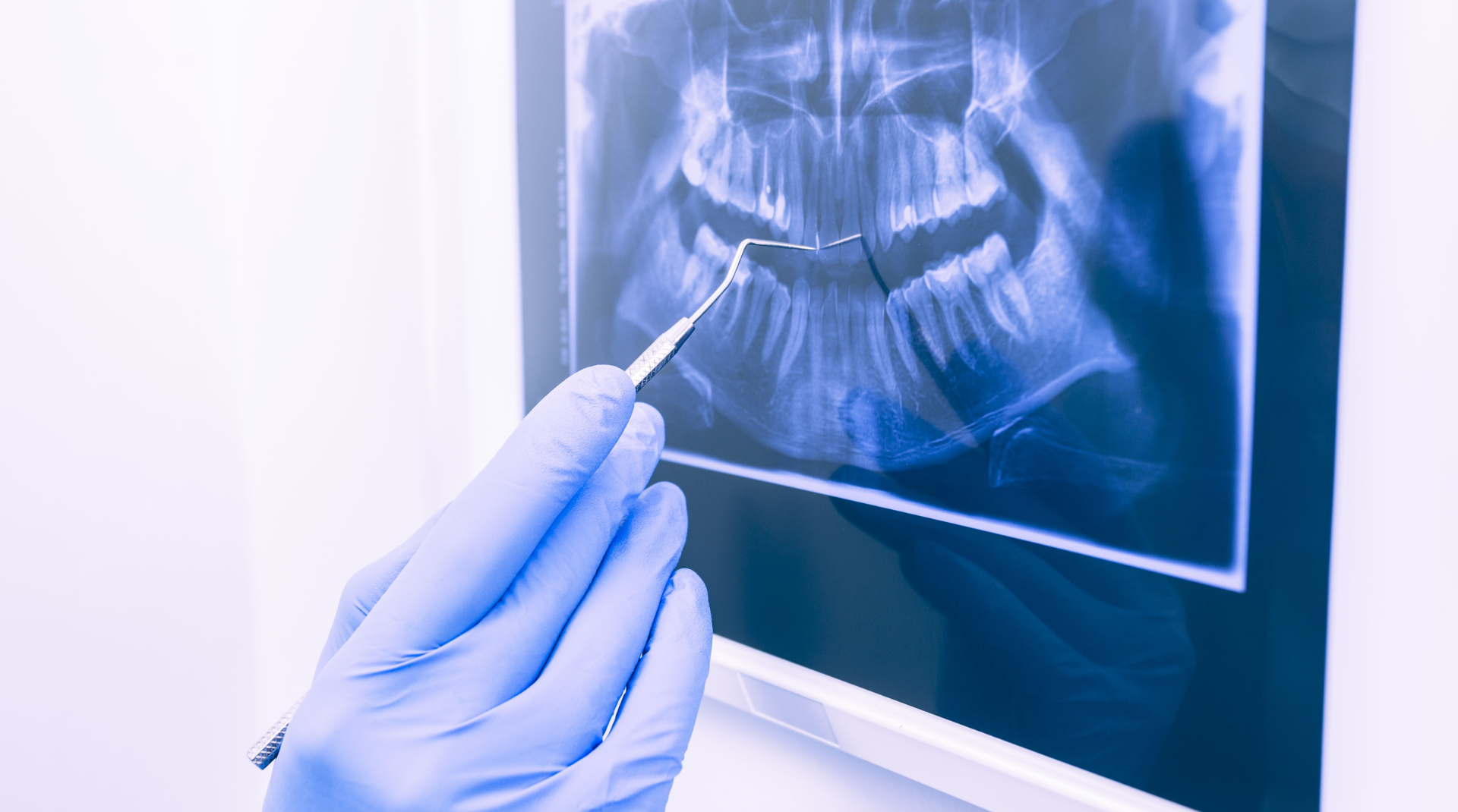 What Is Pinhole Gum Rejuvenation and How Does It Work?