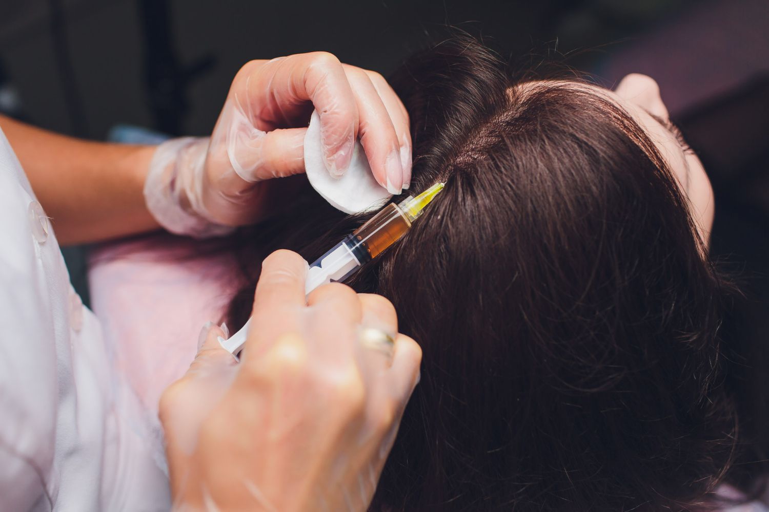 Person receiving a scalp injection for hair treatment. A gloved hand holds a syringe, injecting a substance into the hair.