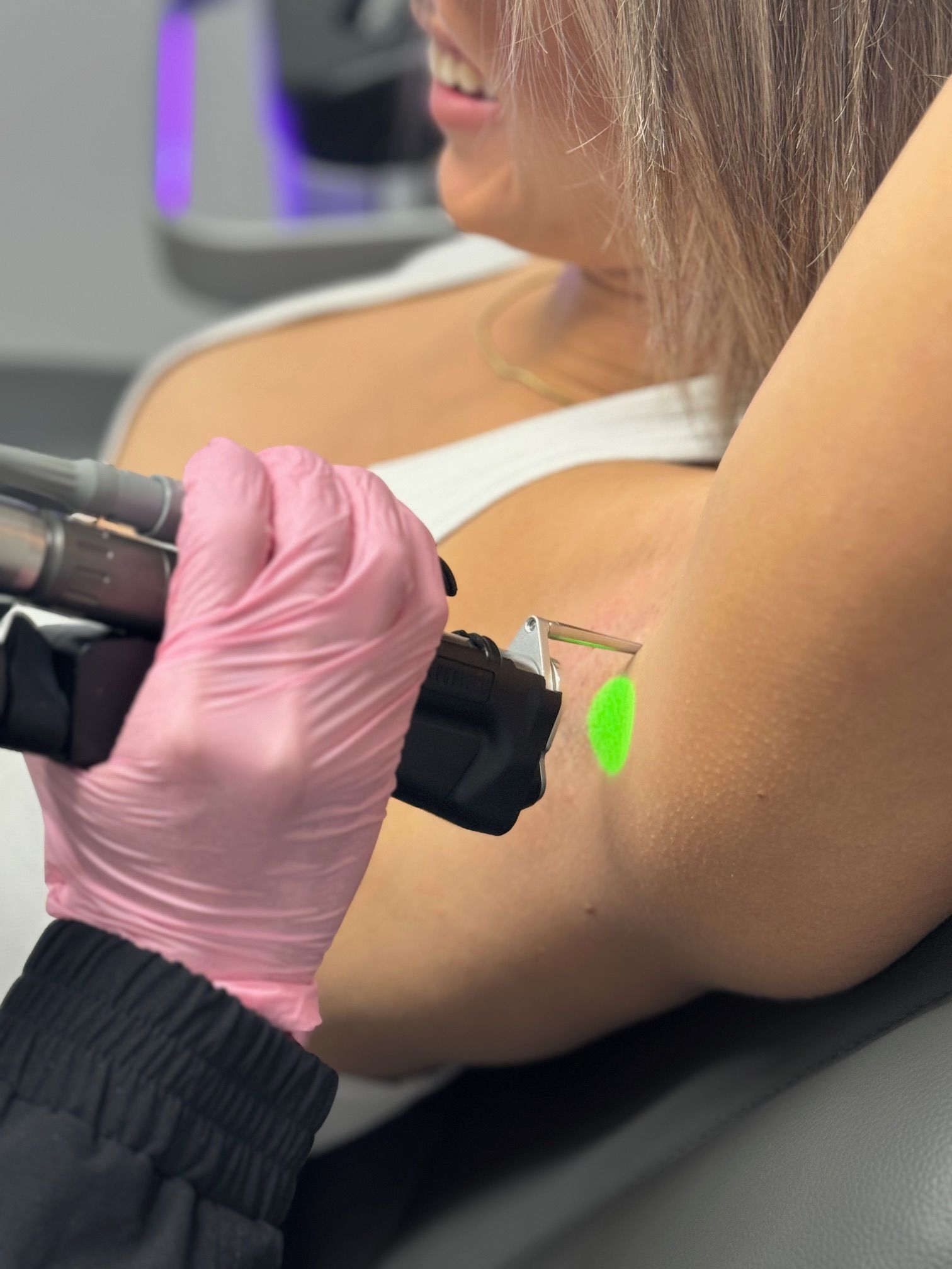 laser hair removal huntington beach