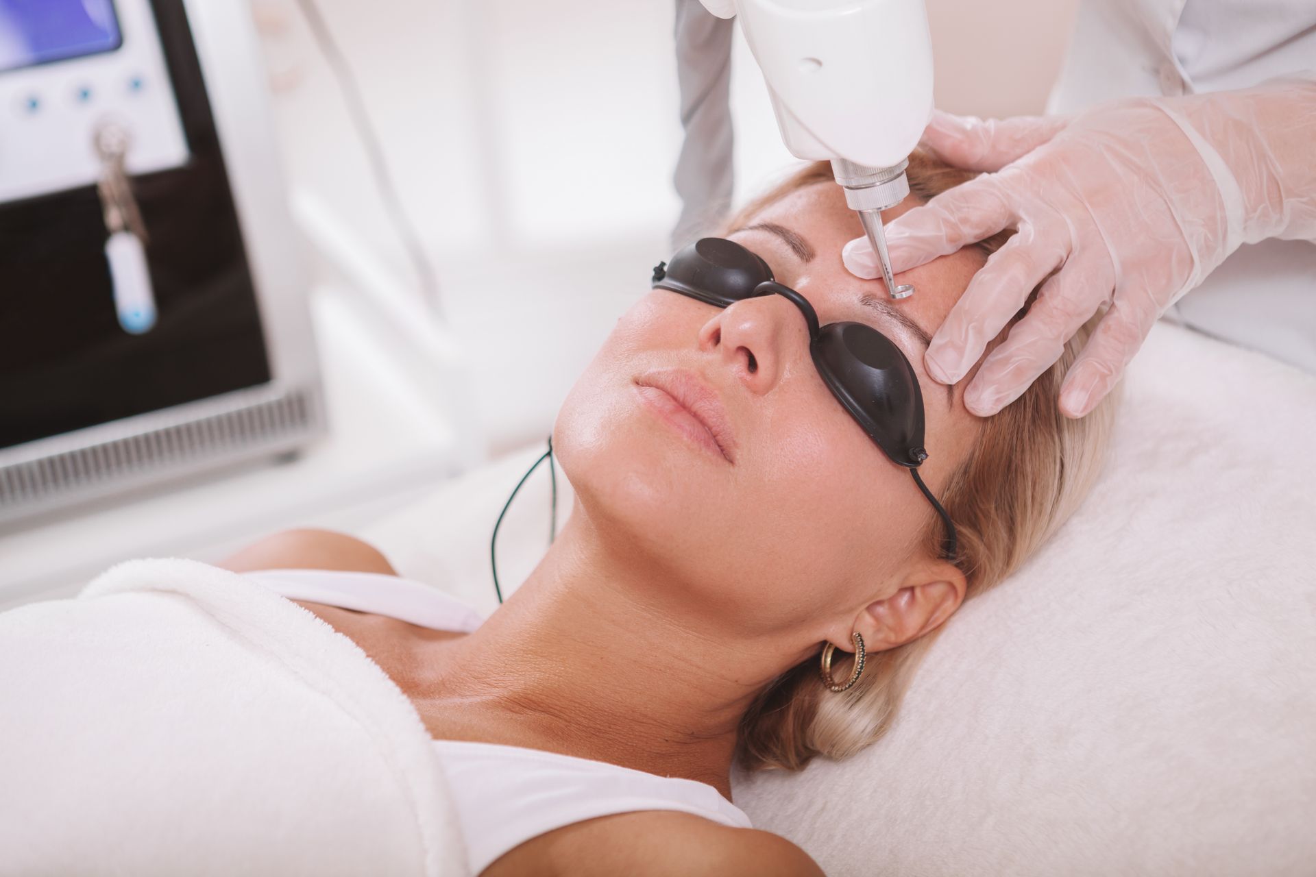 Woman receiving a laser skin treatment on her forehead, wearing protective goggles.