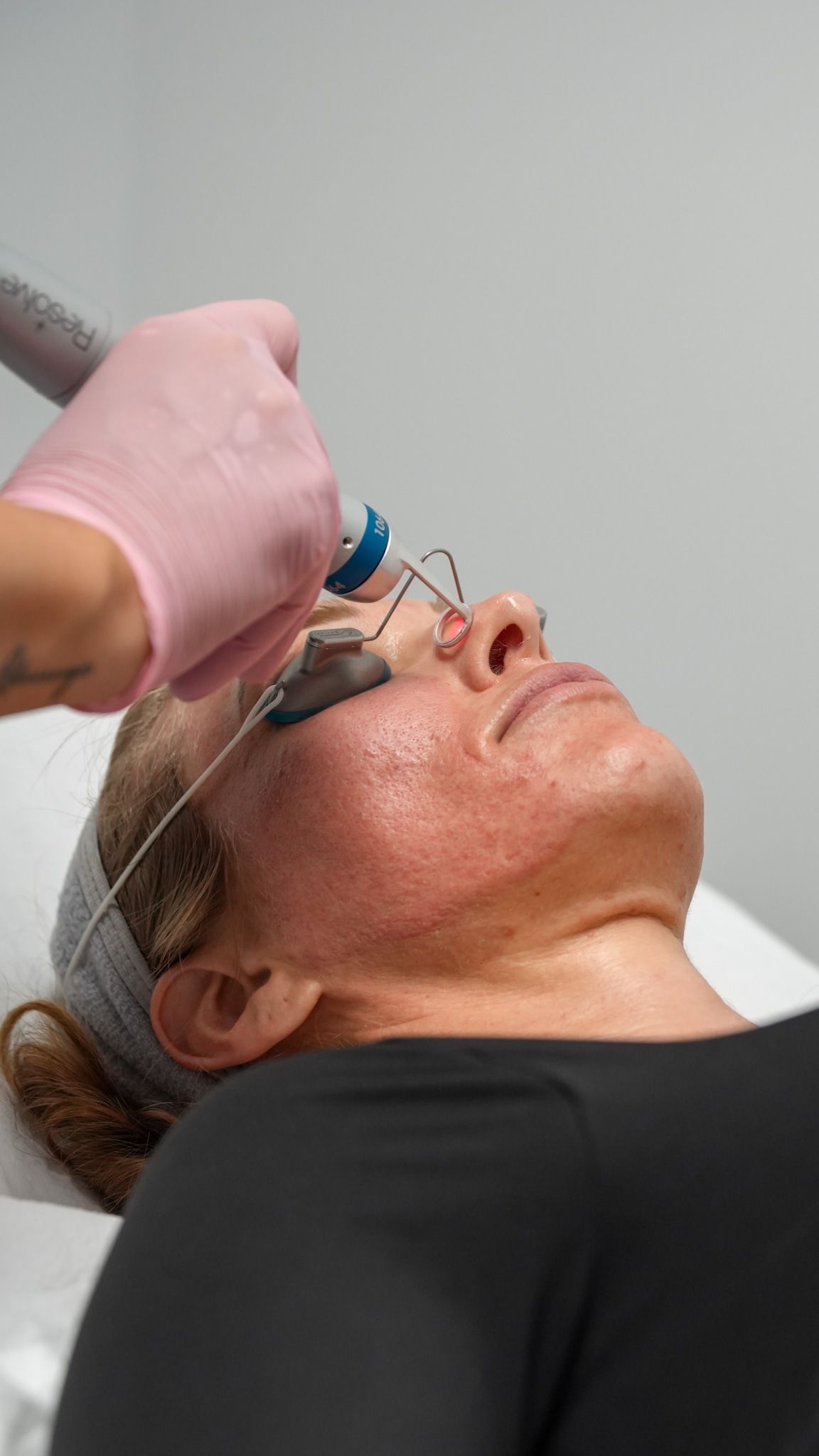 A man wearing sunglasses is getting a laser hair removal treatment on his back.