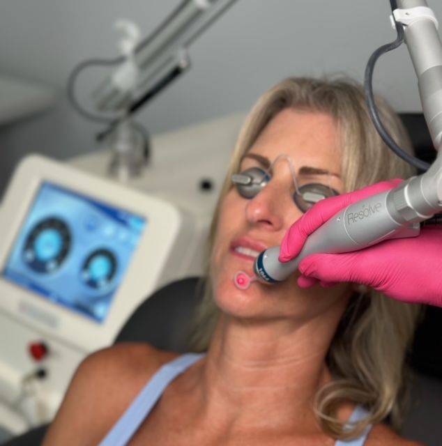 A woman is getting a laser treatment on her face.