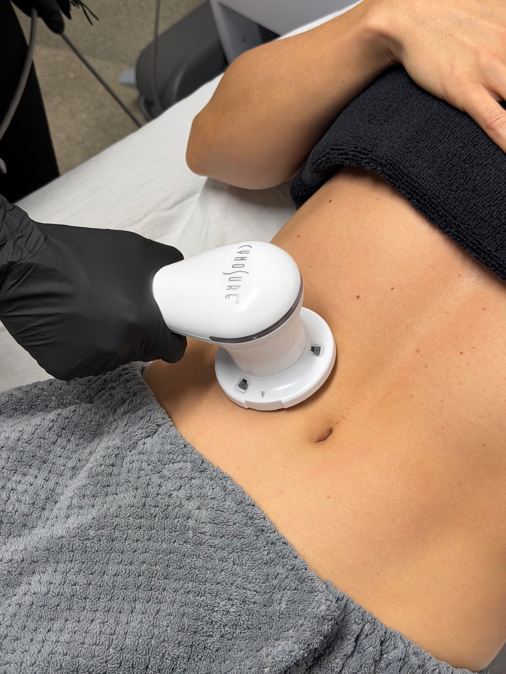 tempsure envi firm skin tightening neck huntington beach