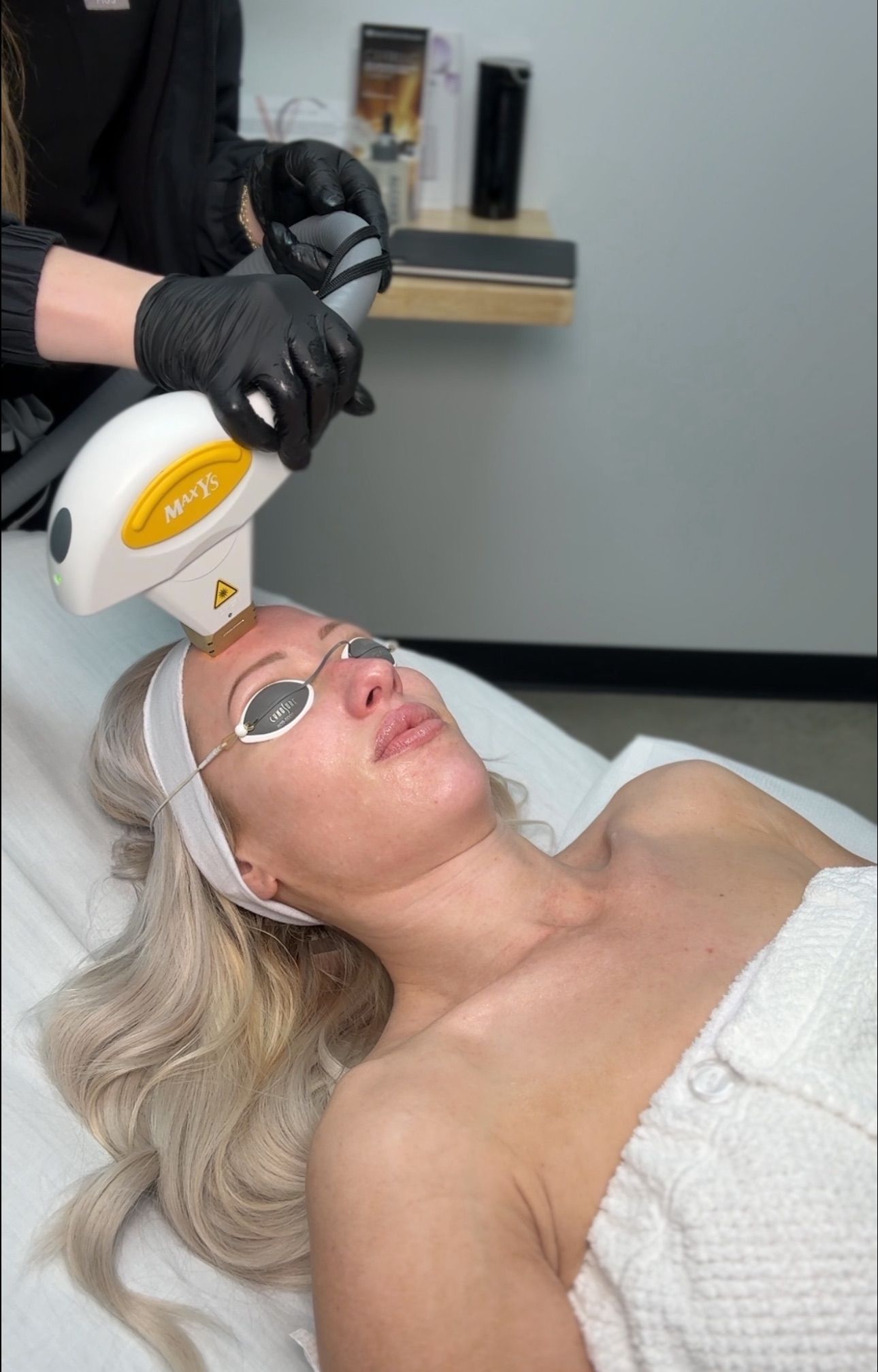 ipl photofacial huntington beach