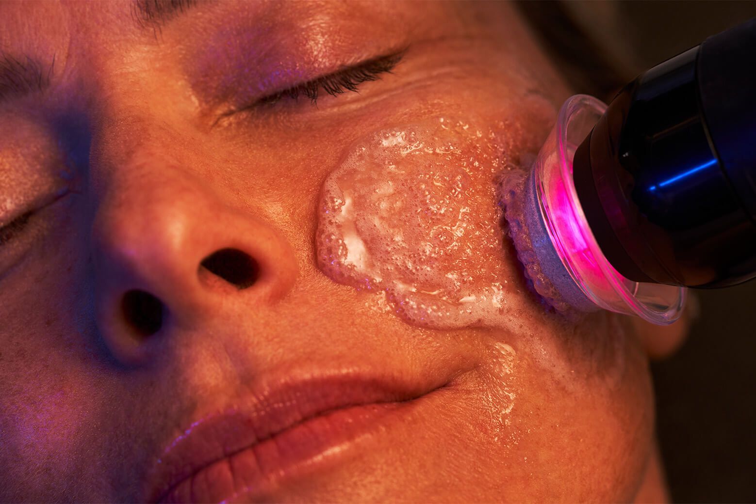 A woman is getting a hydrafacial treatment Huntington Beach