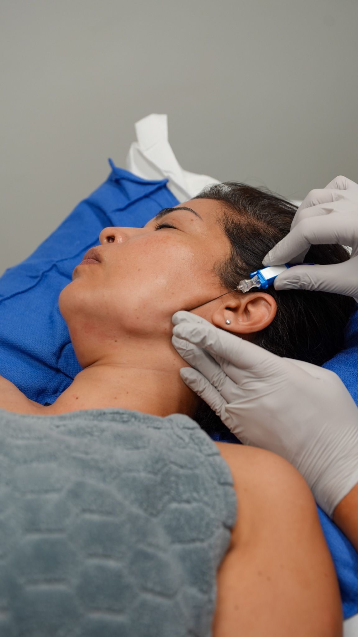 attiva skin tightening