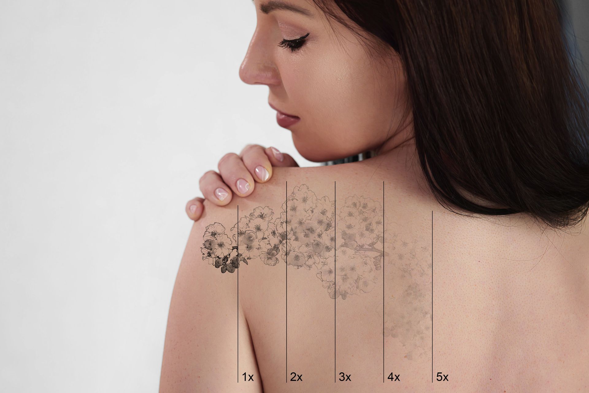 A woman with a tattoo on her back is showing the process of removing a tattoo.