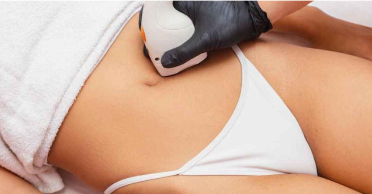 Does Brazilian Laser Hair Removal Hurt?
