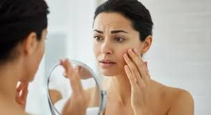 Can I Bleach My Face After Laser Hair Removal?
