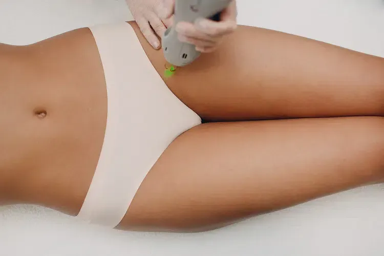 How Often Should You Get Brazilian Laser Hair Removal?