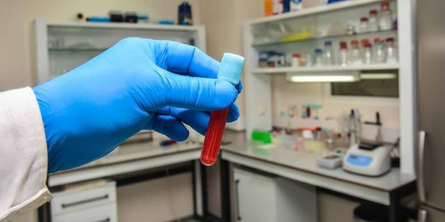 https://lirp.cdn-website.com/1eb71eb4/dms3rep/multi/opt/veterinary-laboratory-diagnostic-services-640w.jpg