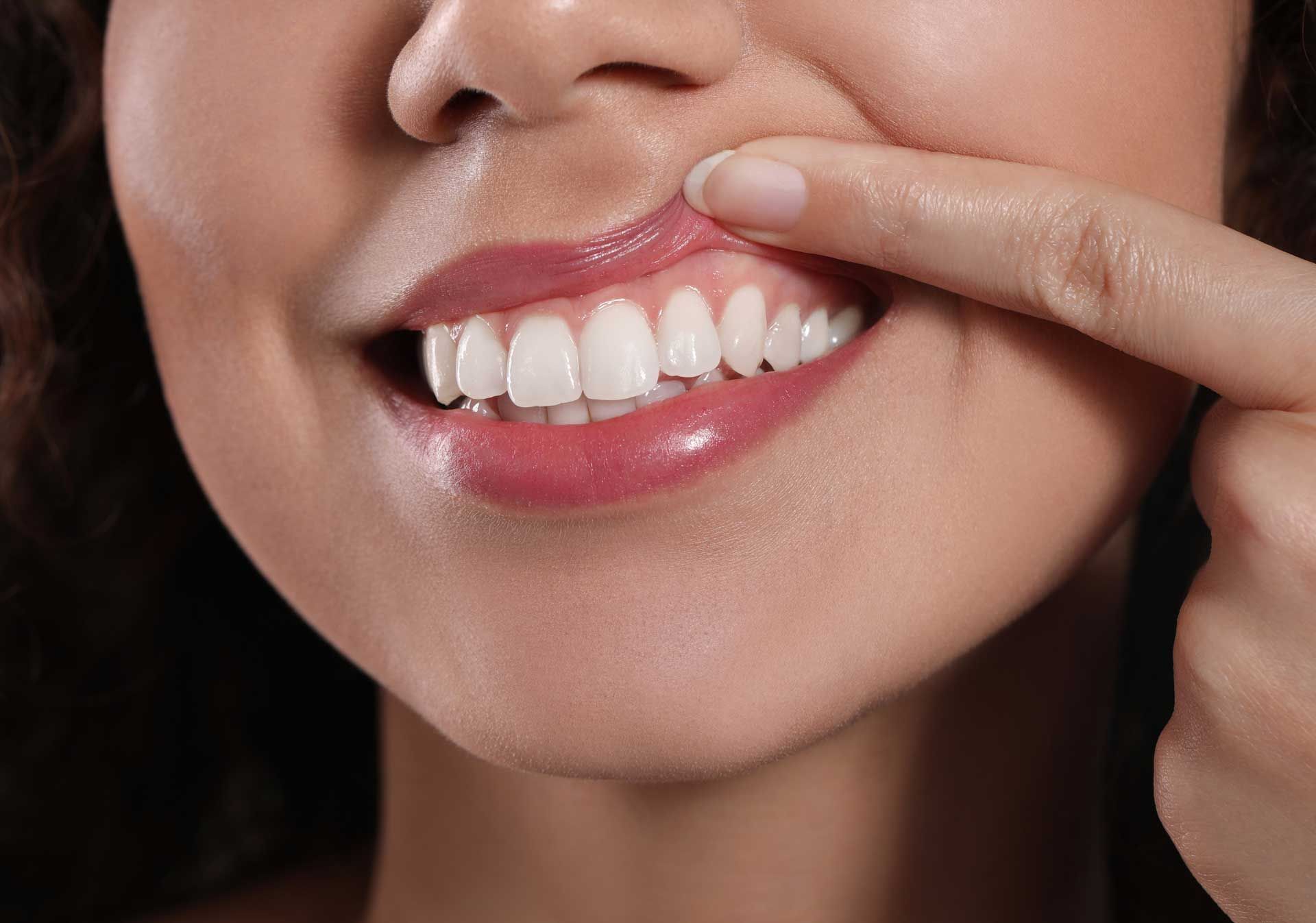 A woman is touching her teeth with her finger.