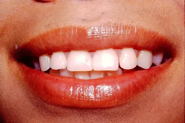 A close up of a woman 's mouth with white teeth and red lips.