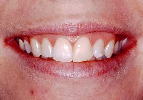 A close up of a person 's mouth with white teeth and red lips.