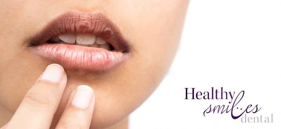 Woman Holding Lips - Anchorage, AK - Healthy Smiles Dental