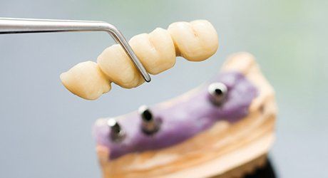 I offer high-quality dentures at affordable prices