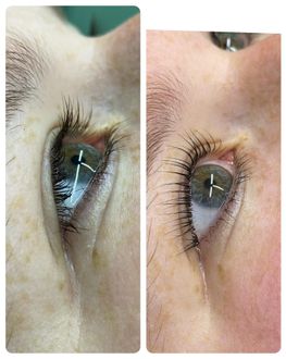 Before and after photos of an eye, showing thicker, darker eyelashes after treatment.