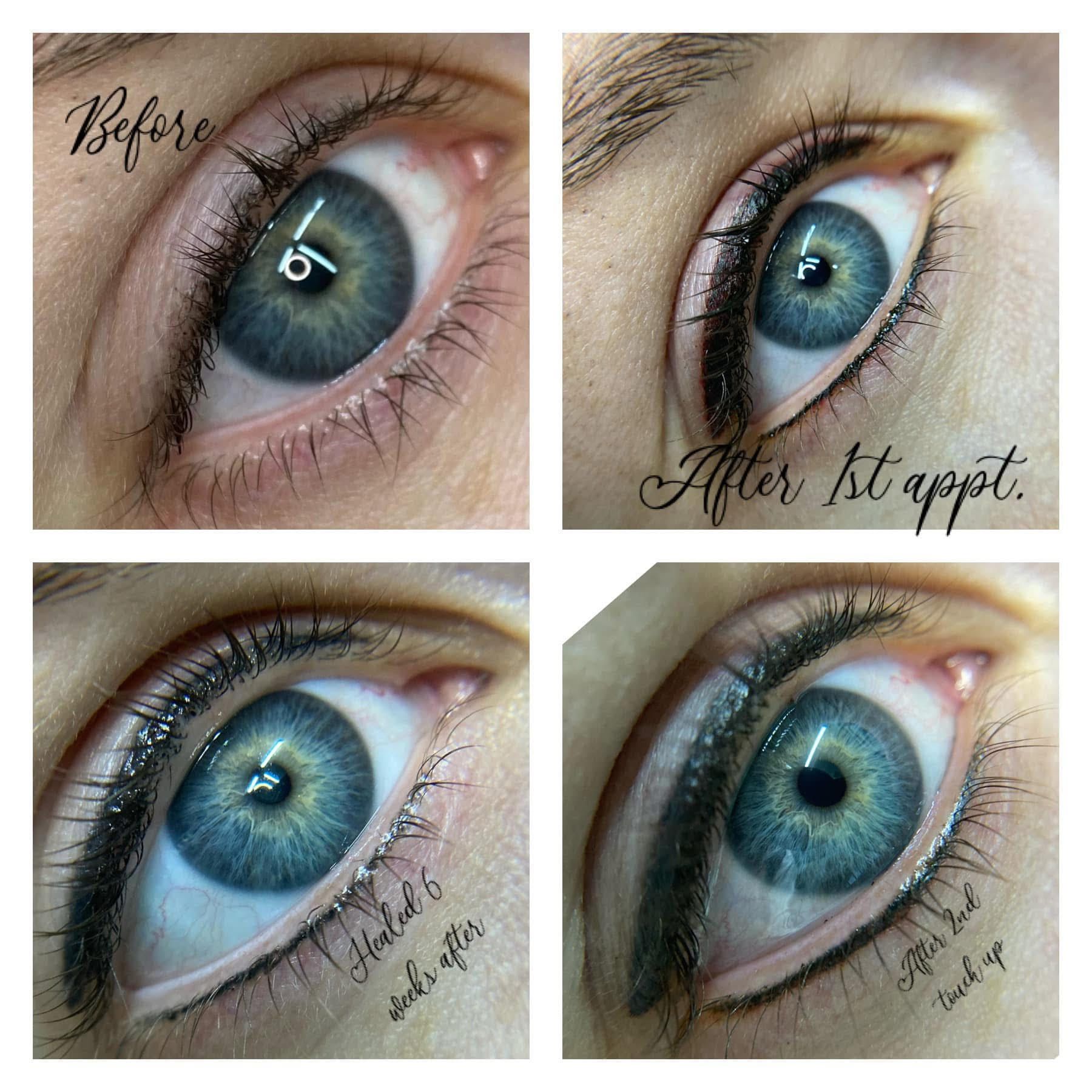 Eye with before and after photos of eyeliner tattoo; changes are shown after initial and touch-up sessions.