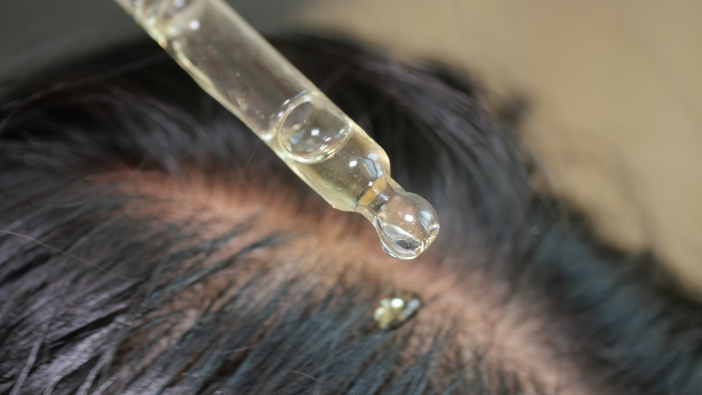 best hair restoration in savannah ga