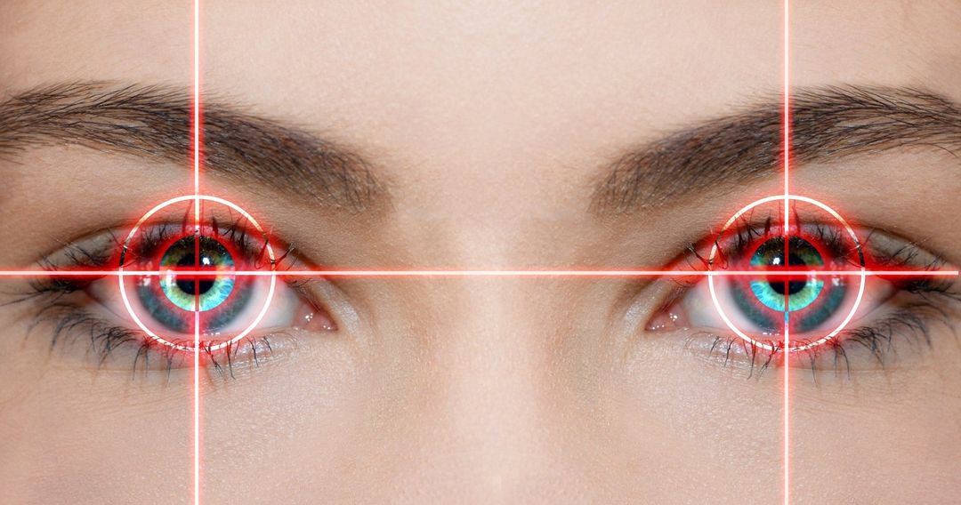 chirurgia laser per gli occhi