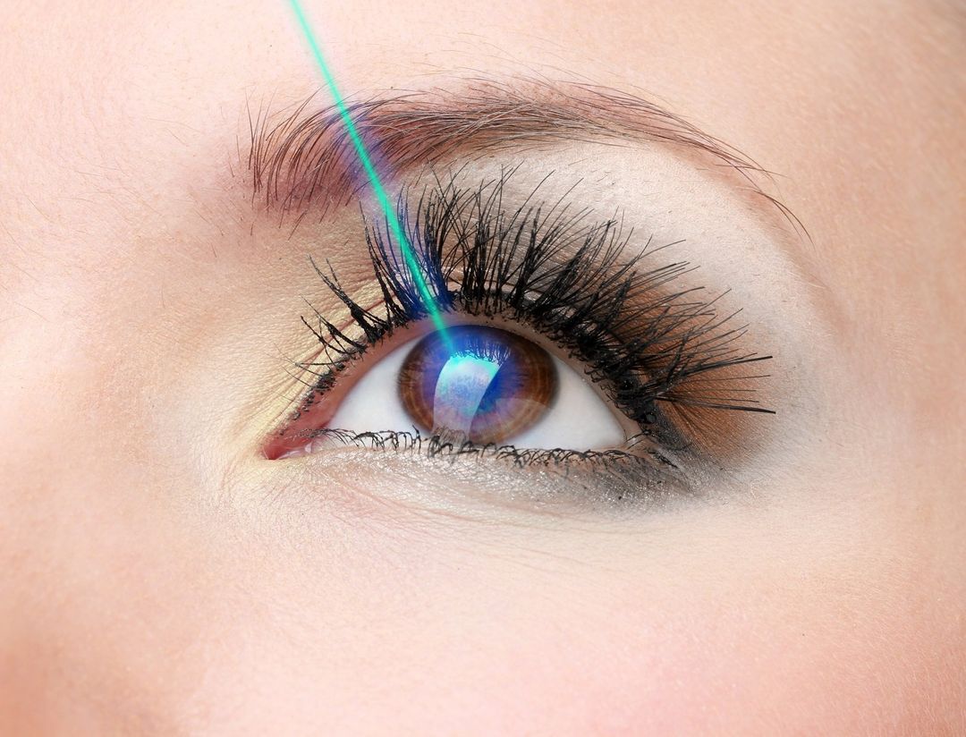 trattamento con laser per gli occhi