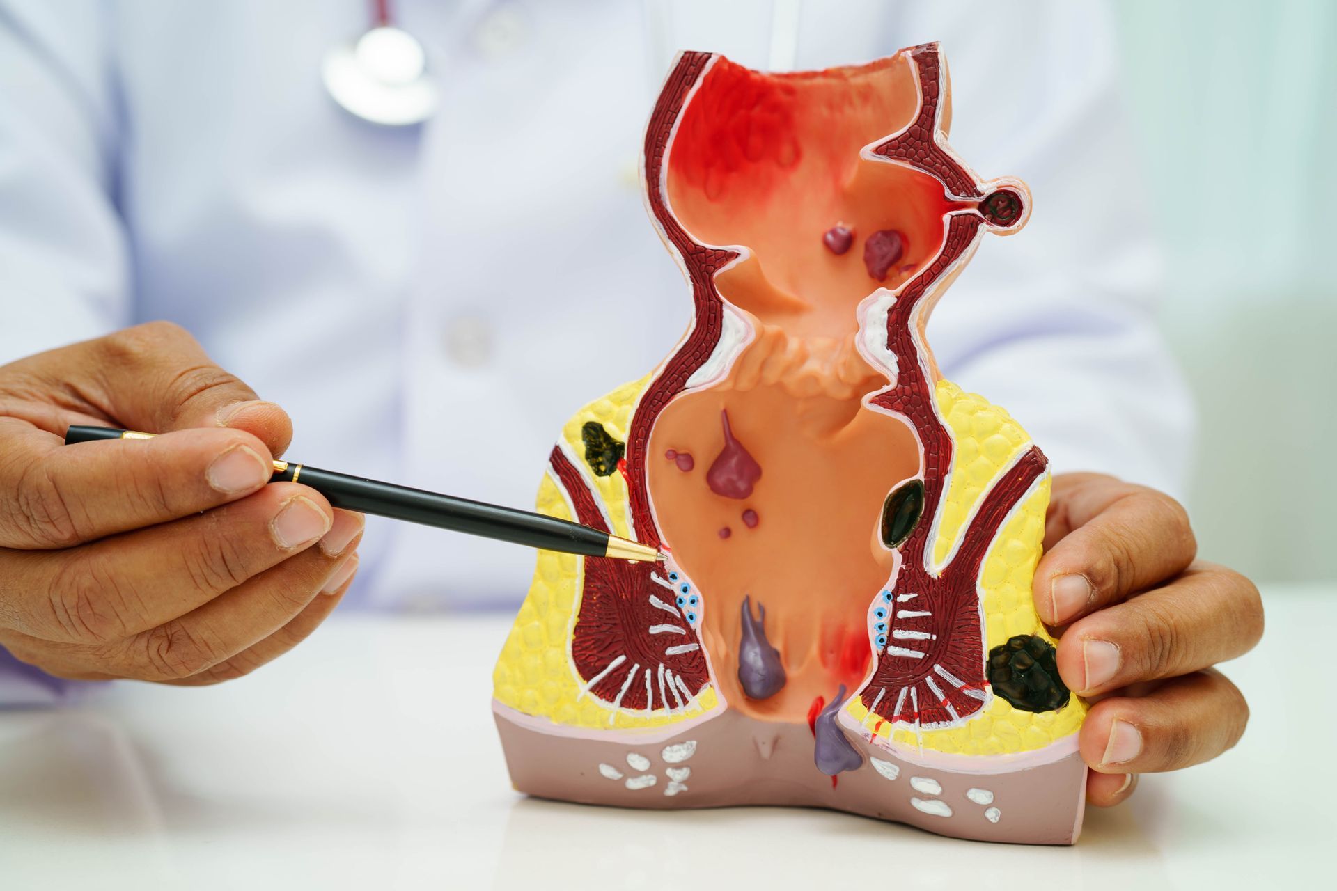 Doctor pointing at a kidney anatomy model with a pen in a medical setting
