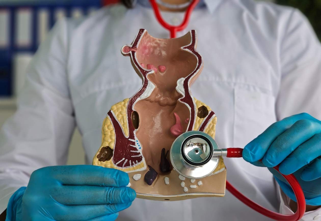 A doctor uses a stethoscope on a rectum model showing hemorrhoids in the clinic.
