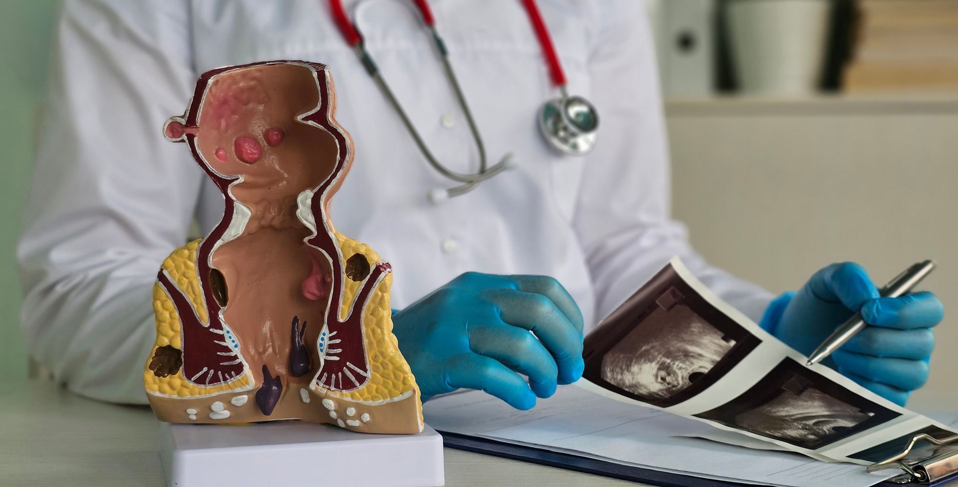 Doctor rectal examination and transrectal ultrasound.