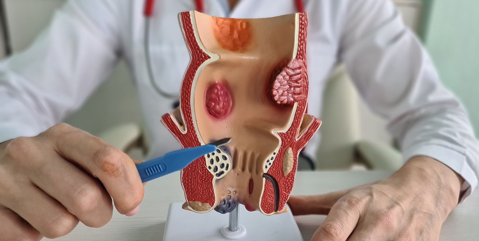 Hands holding a medical model of a human torso with visible organs and intestines