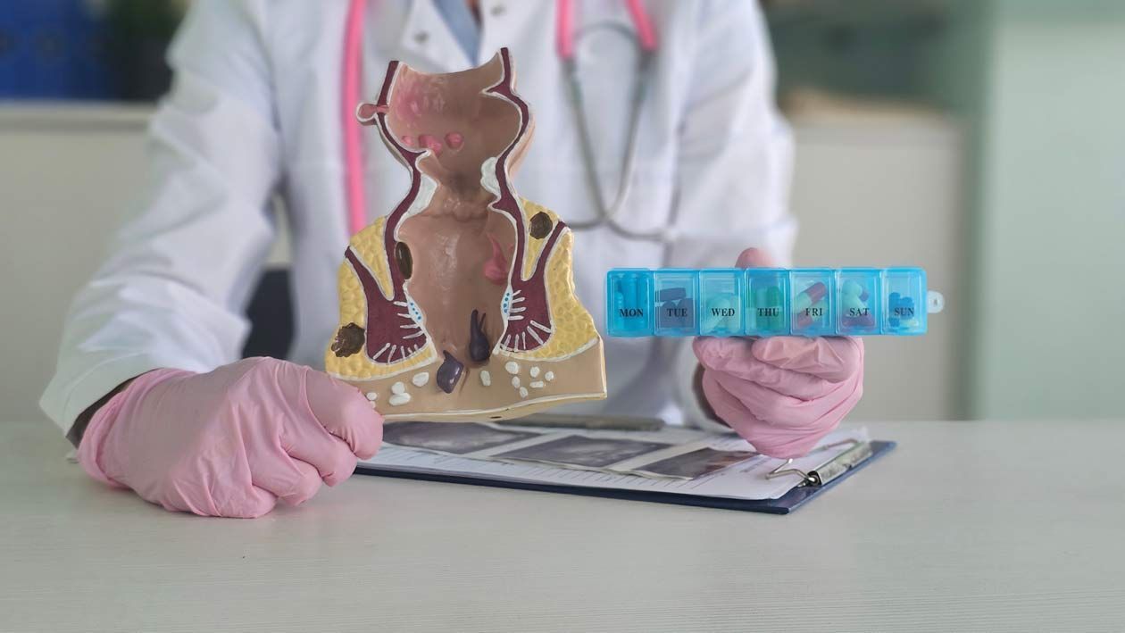 A doctor wearing gloves holding an anatomical rectum model and a blue pill organizer on a desk