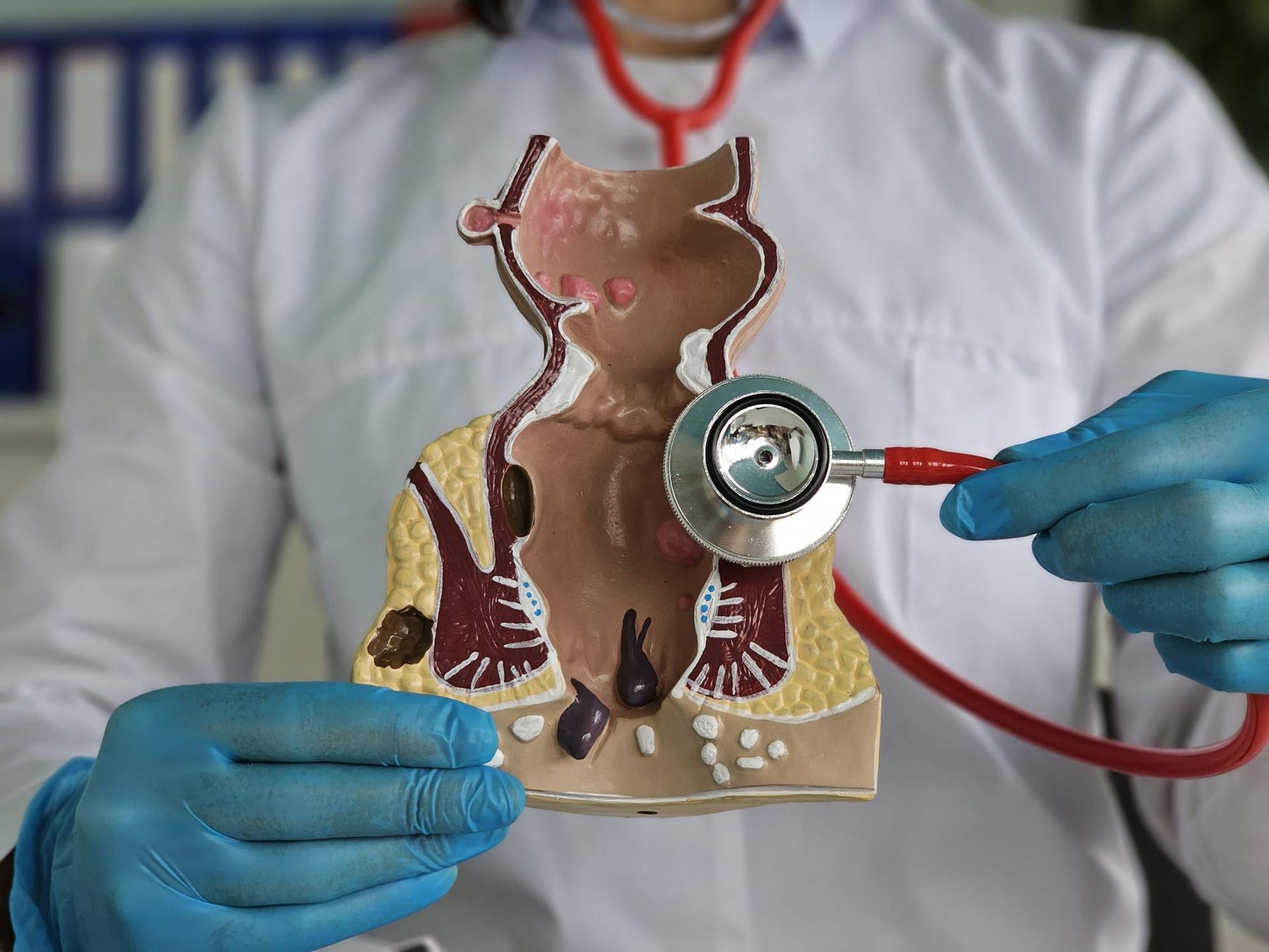 A doctor uses a stethoscope on a rectum model showing hemorrhoids in the clinic.